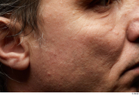  HD Face Skin Benito Romero cheek ear face scar skin pores skin texture 0001.jpg
